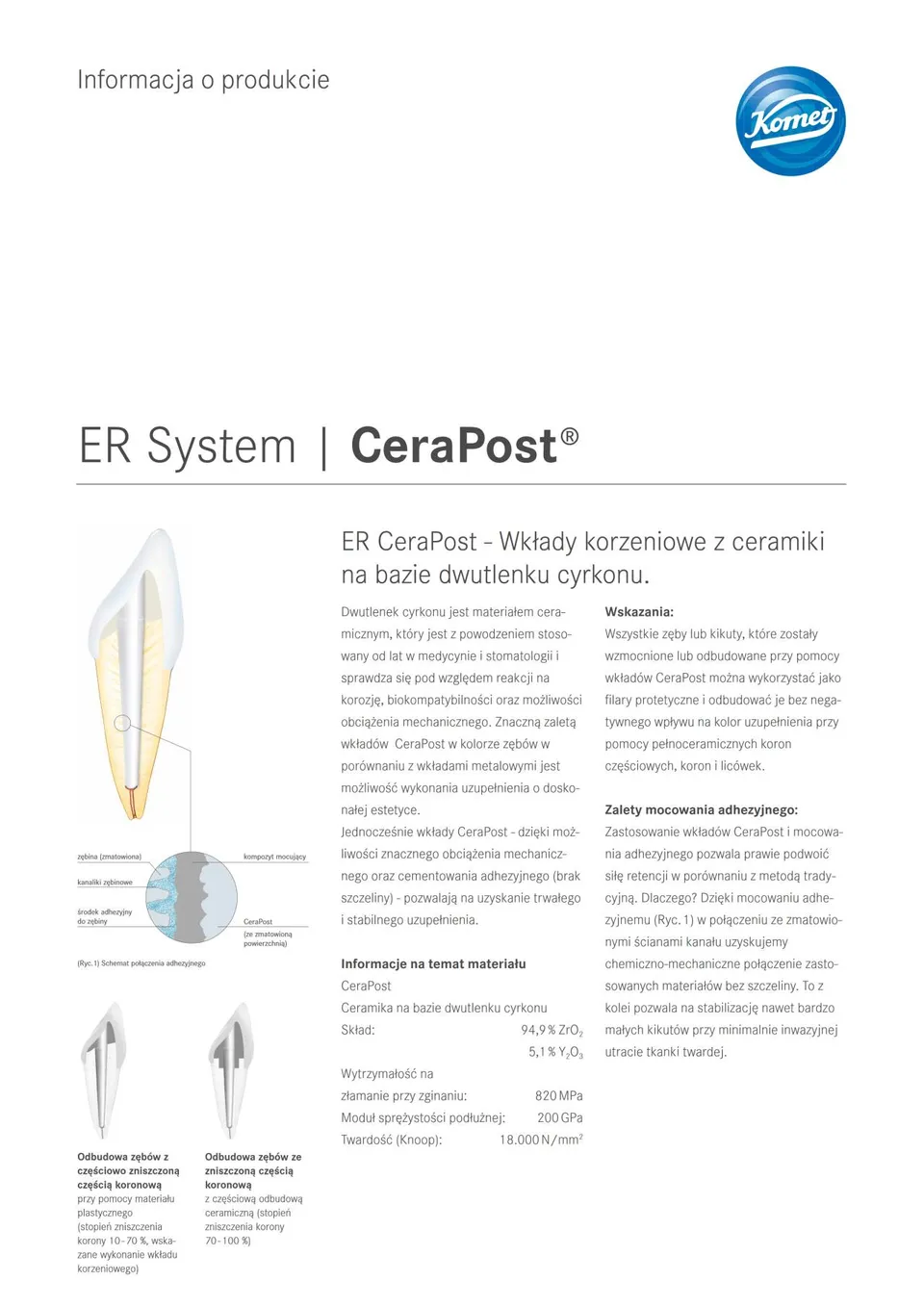 komet-cerapost-produktinformation-wurzelstift-zirkonoxid image 1