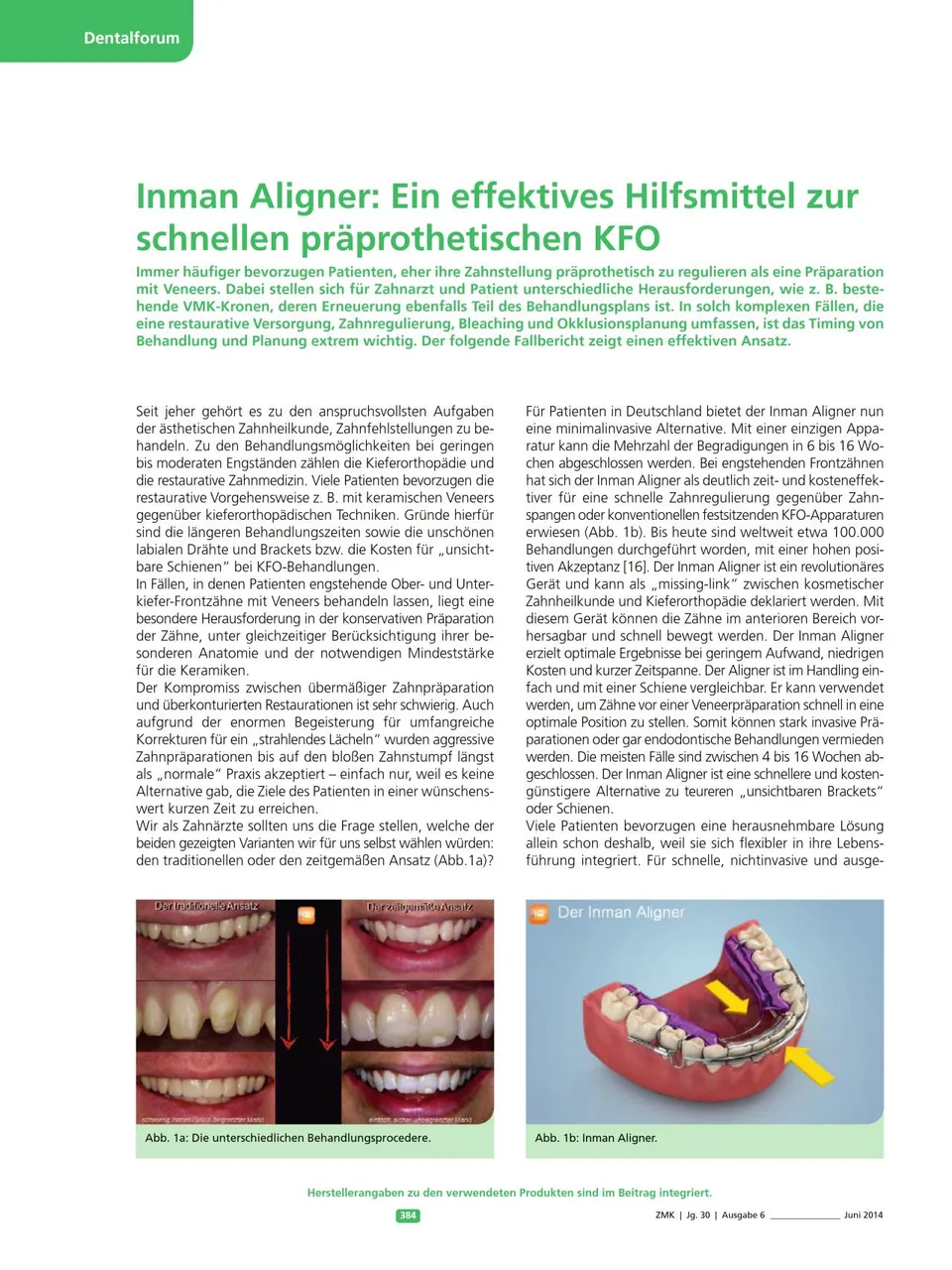 komet-sonicline-pr-prothetische-kfo-fachbericht-nolte image 1