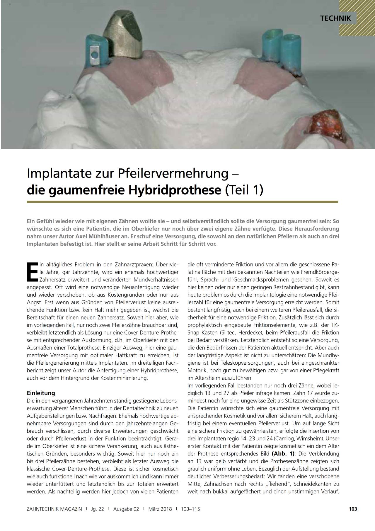 komet-fq-fachbericht-hybridprothese-pfeilervermehrung-teil-1 image 1
