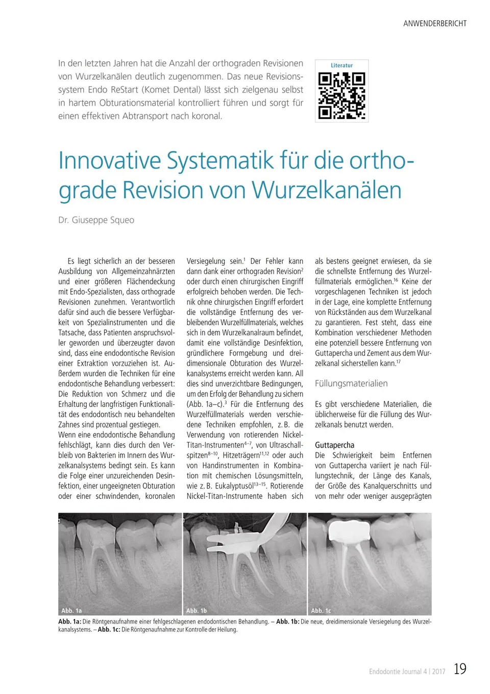 komet-dental-fq-fachbeitrag-orthograde-wurzelkanalrevision image 1