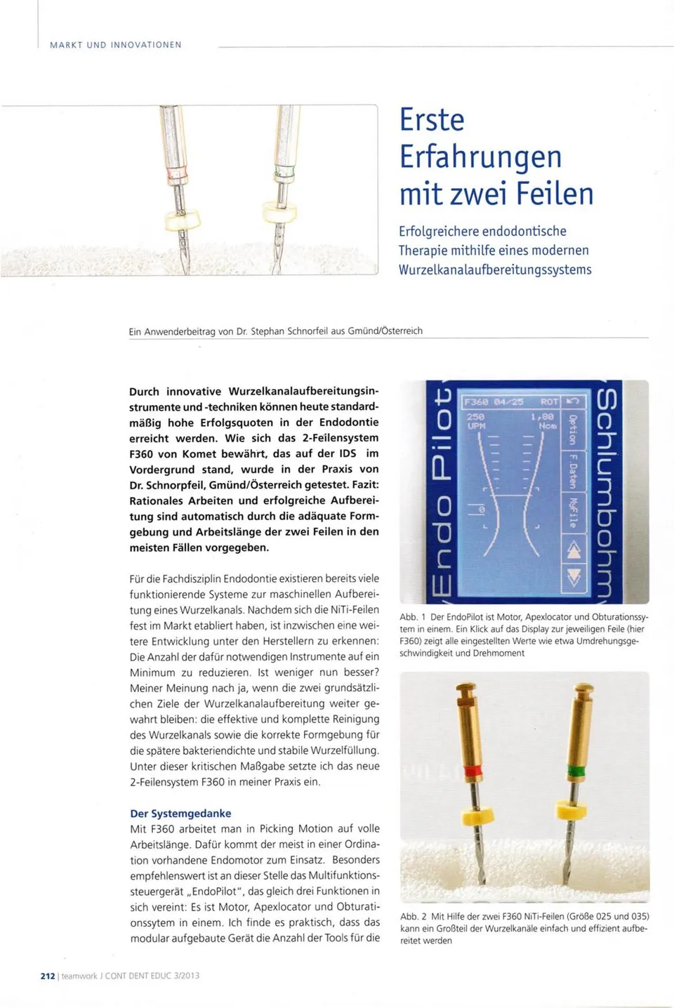komet-dental-fq-fachbericht-zwei-feilen-aufbereitung image 1