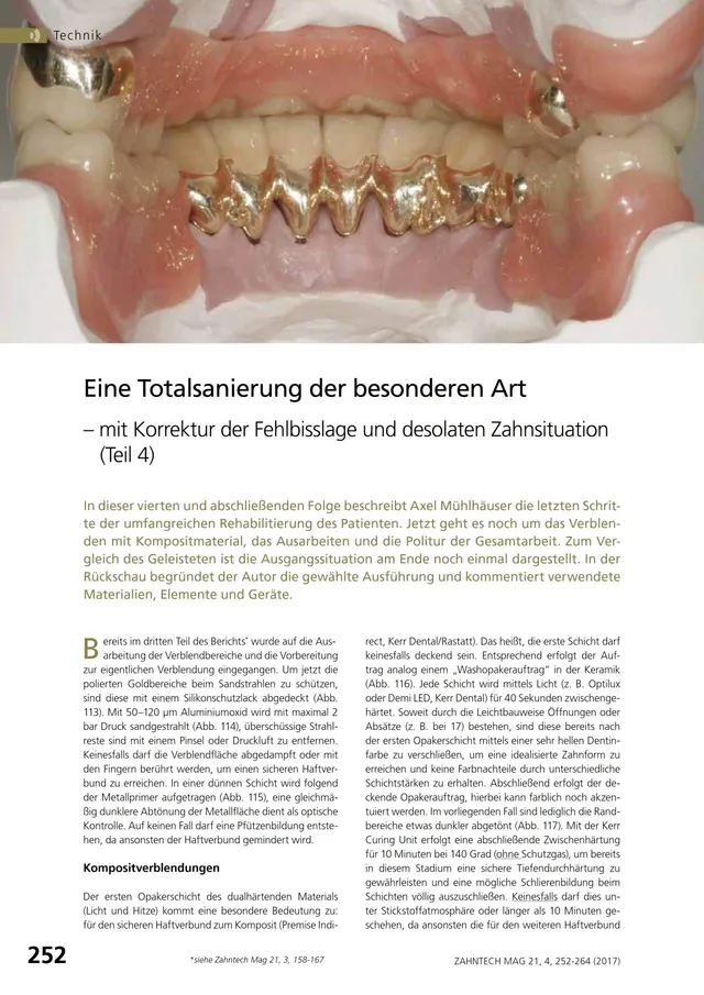 komet-diao-fachbericht-totalsanierung-teil-4-fehlbisslage image 1