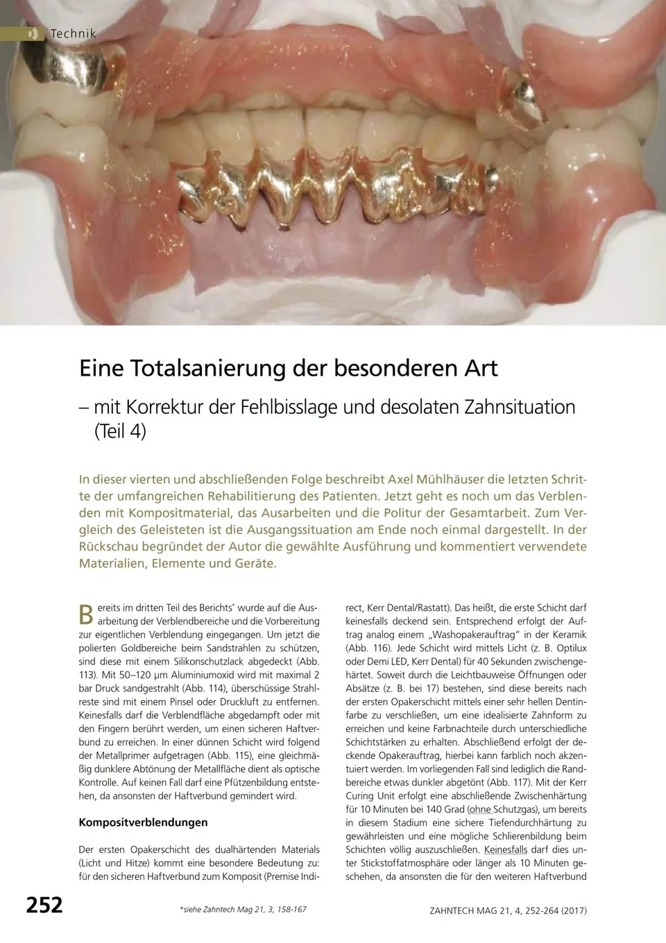 komet-diao-fachbericht-totalsanierung-teil-4-fehlbisslage image 1