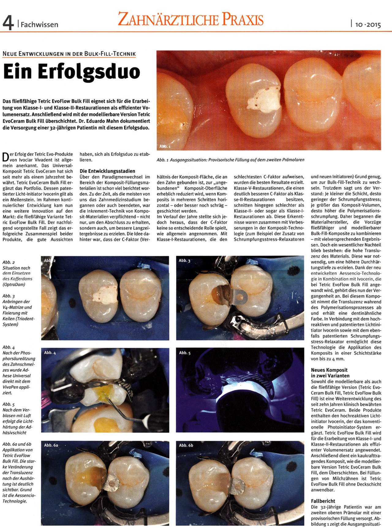 komet-dental-ceracut-fb-schallspitze-composite-f-llung image 1