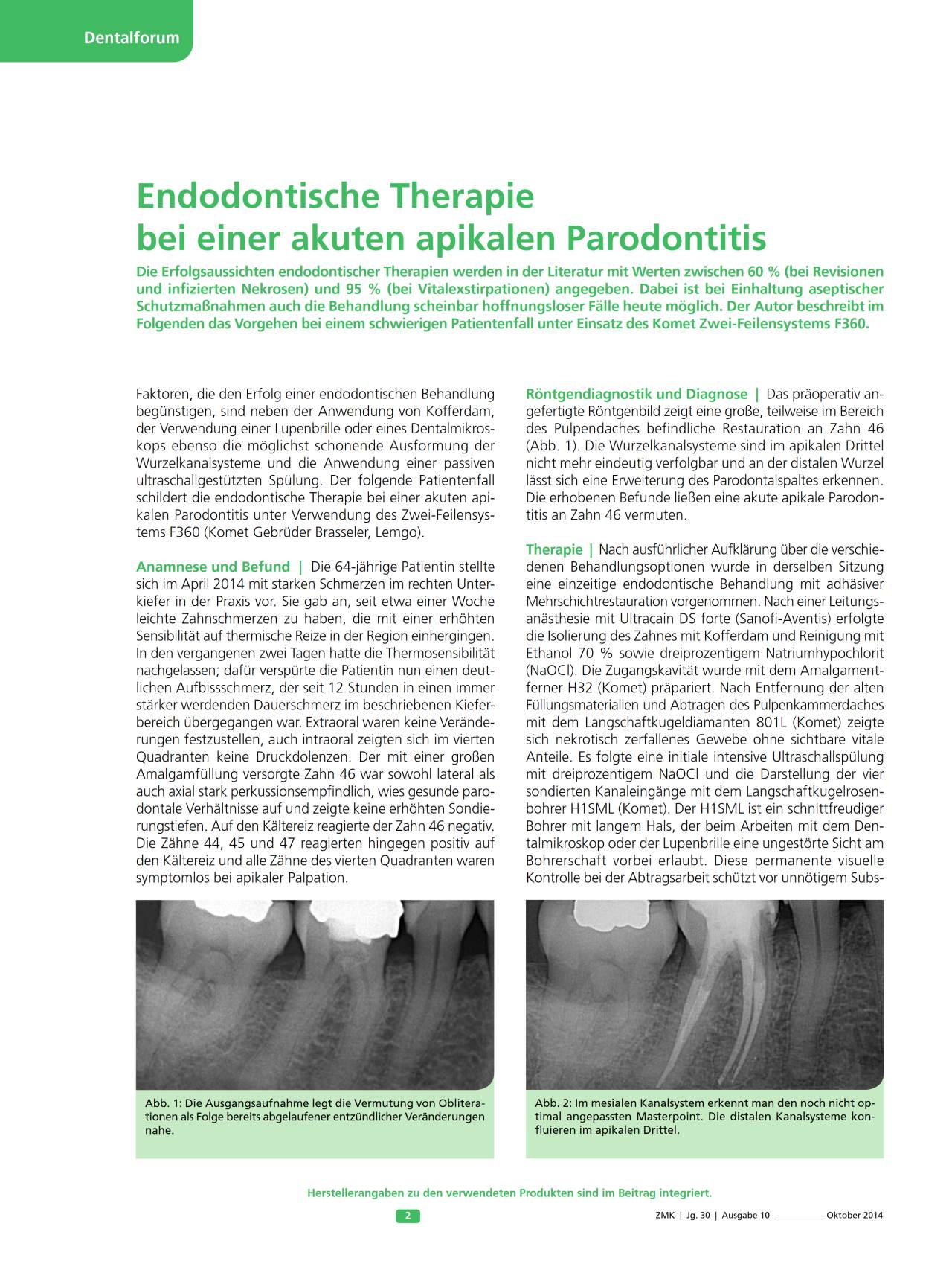 komet-dental-fq-fachbericht-f360-endo-parodontitis-therapie image 1