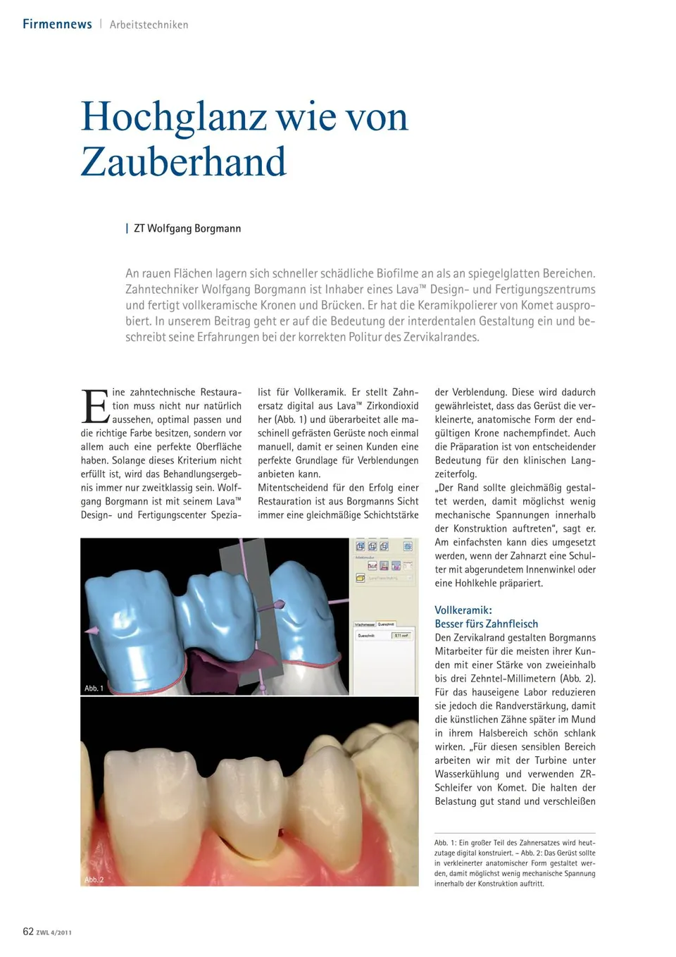 komet-art2-fachbericht-keramikpolierer-hochglanz-borgmann image 1