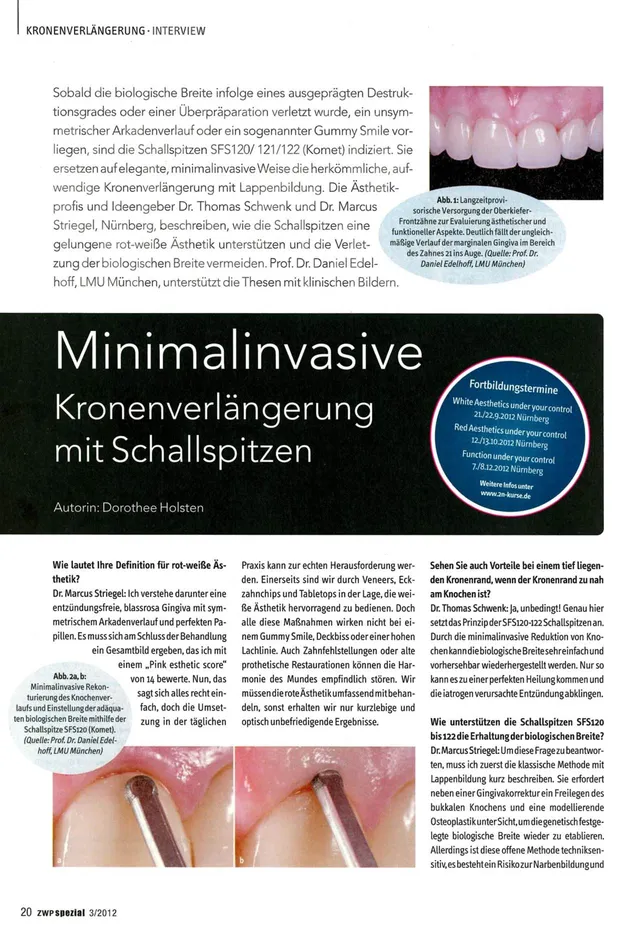 komet-dental-diao-minimalinvasive-kronenverl-ngerung-bericht image 1