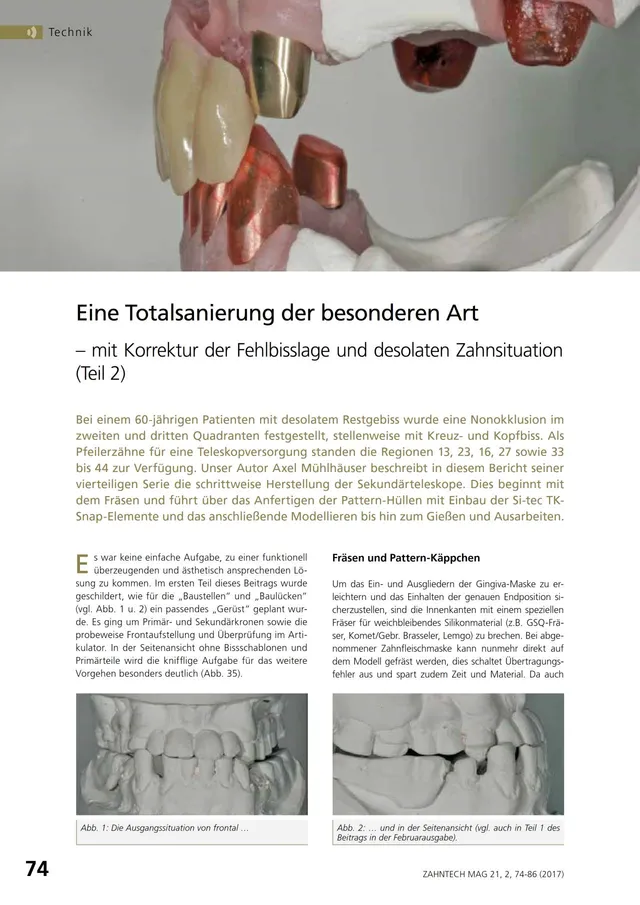 komet-dental-diao-fachbericht-totalsanierung-teil-2-pdf image 1