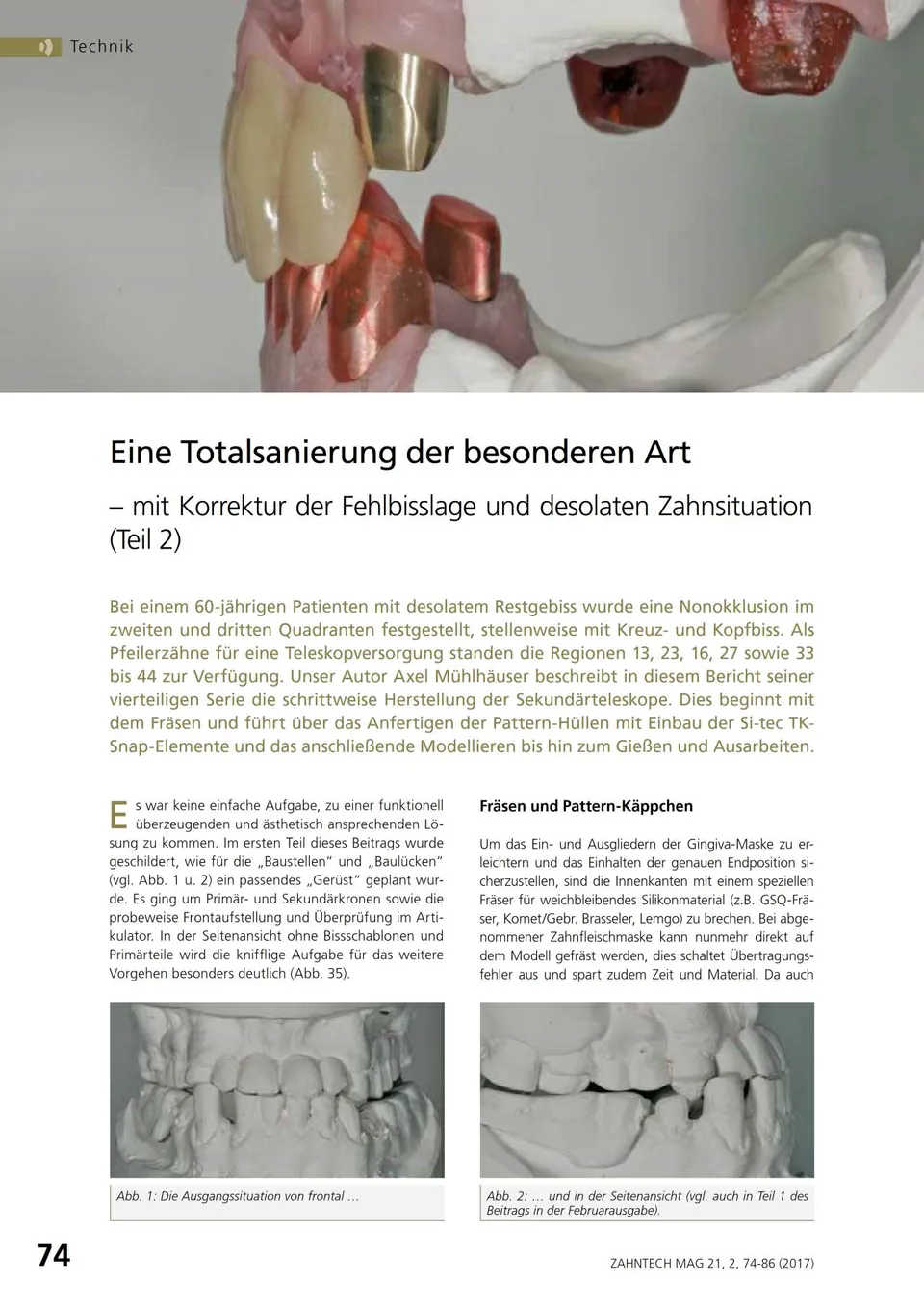 komet-dental-diao-fachbericht-totalsanierung-teil-2-pdf image 1