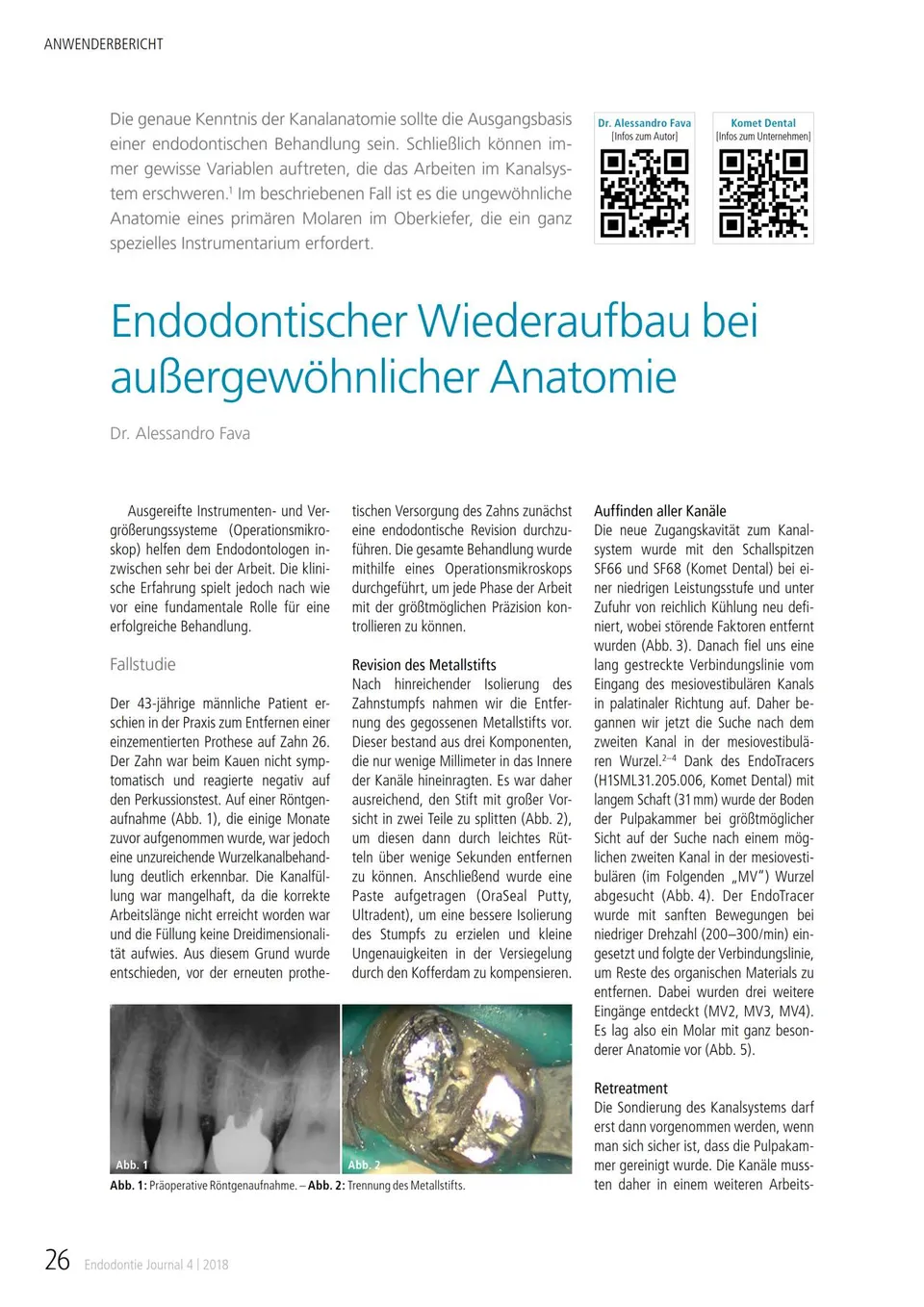 komet-fq-fachbericht-endodontischer-wiederaufbau-anatomie image 1