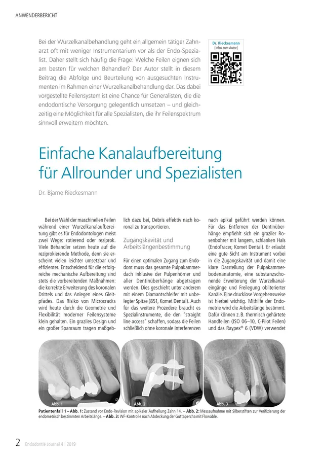komet-fq-fachbericht-kanalaufbereitung-endo-journal-2019 image 1