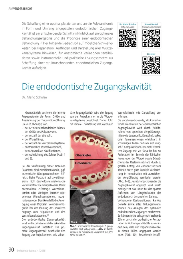 komet-dental-fq-die-endodontische-zugangskavitu00e4t-fachbericht-11-2016 image 1