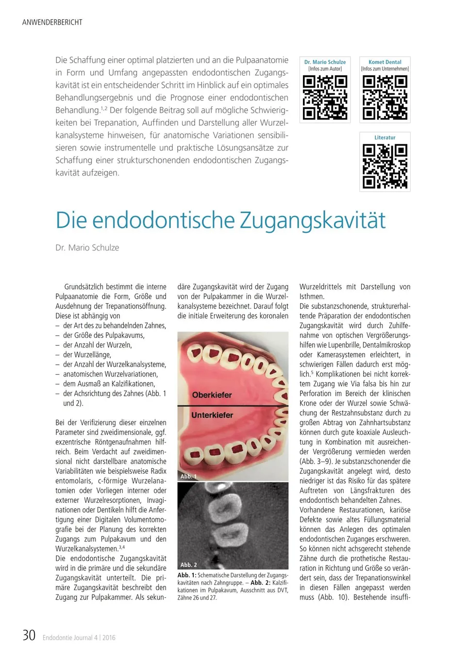 komet-dental-fq-die-endodontische-zugangskavitu00e4t-fachbericht-11-2016 image 1