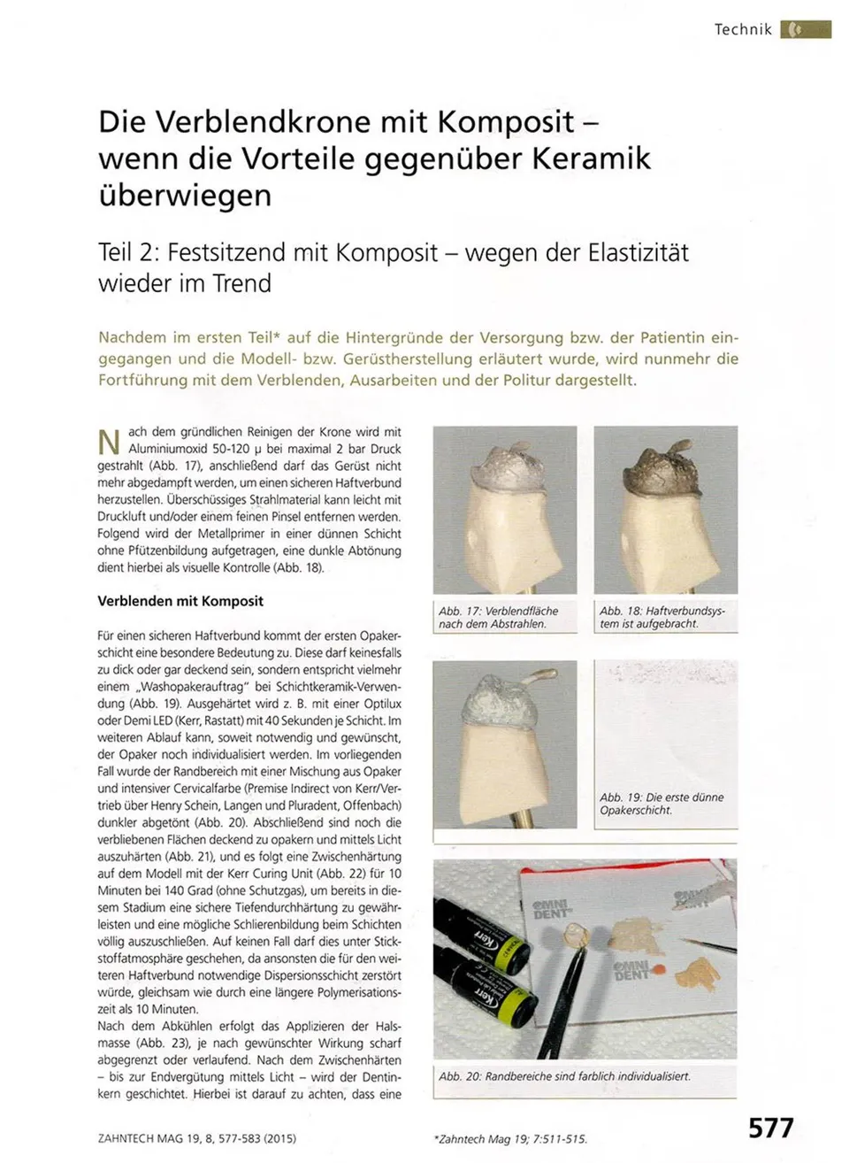 komet-ceracut-verblendkrone-komposit-fachbericht-teil-2 image 1
