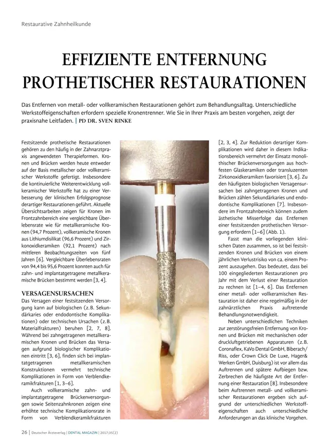 komet-dental-diao-fachbericht-kronentrenner-restauration image 1
