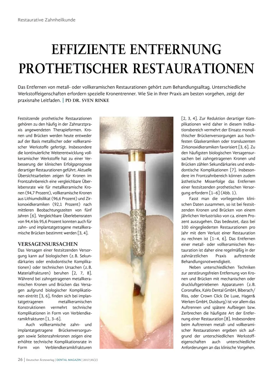 komet-dental-diao-fachbericht-kronentrenner-restauration image 1