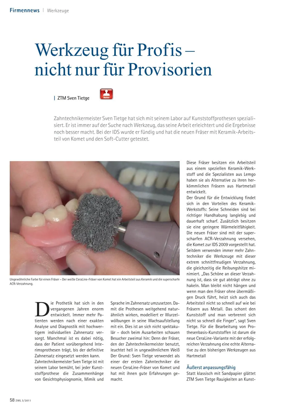 komet-dental-shax-fachbericht-laborinnovationen-ids image 1
