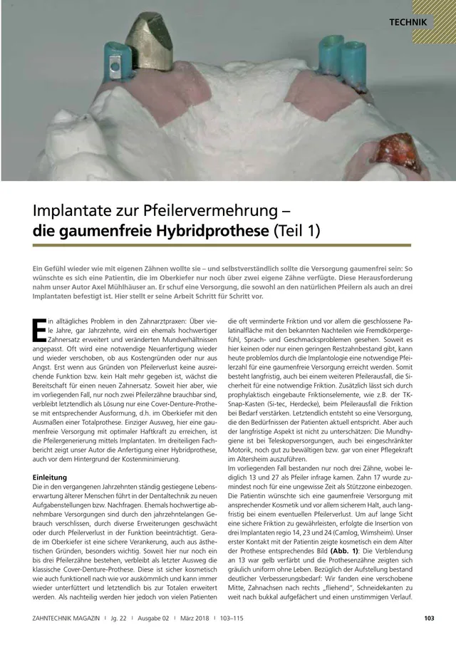 komet-fq-fachbericht-hybridprothese-pfeilervermehrung-teil-1 image 1
