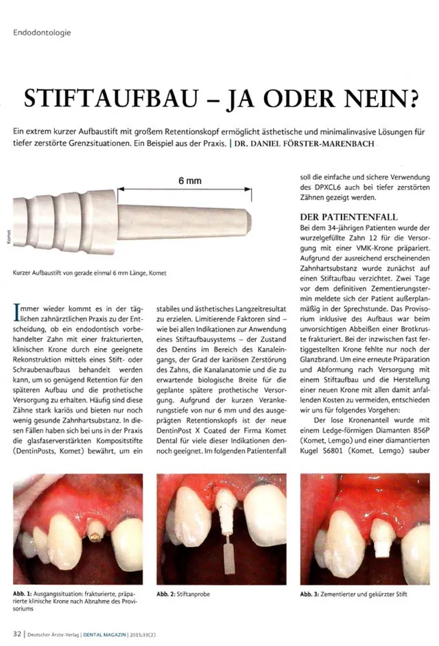 komet-dental-cerapost-stiftaufbau-fachbericht-aufbaustift image 1