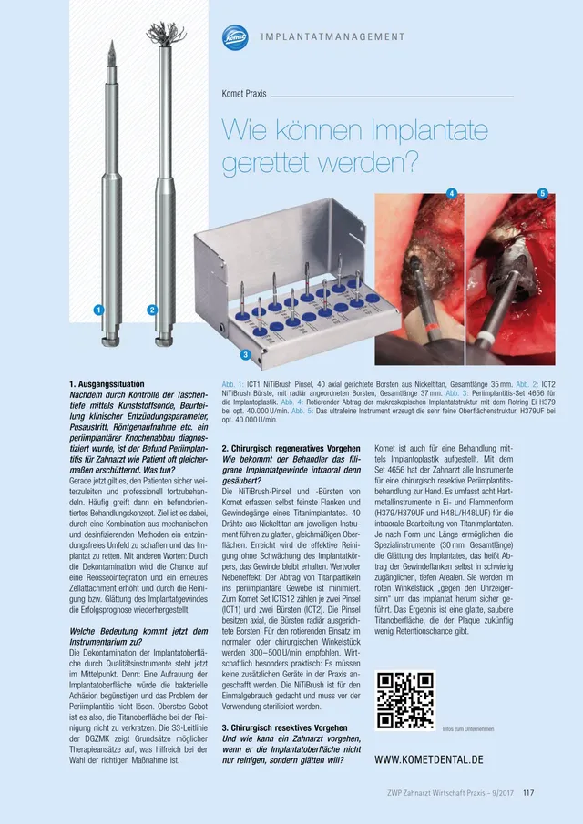 komet-dental-diao-2017-09-praxisartikel-implantate-retten image 1
