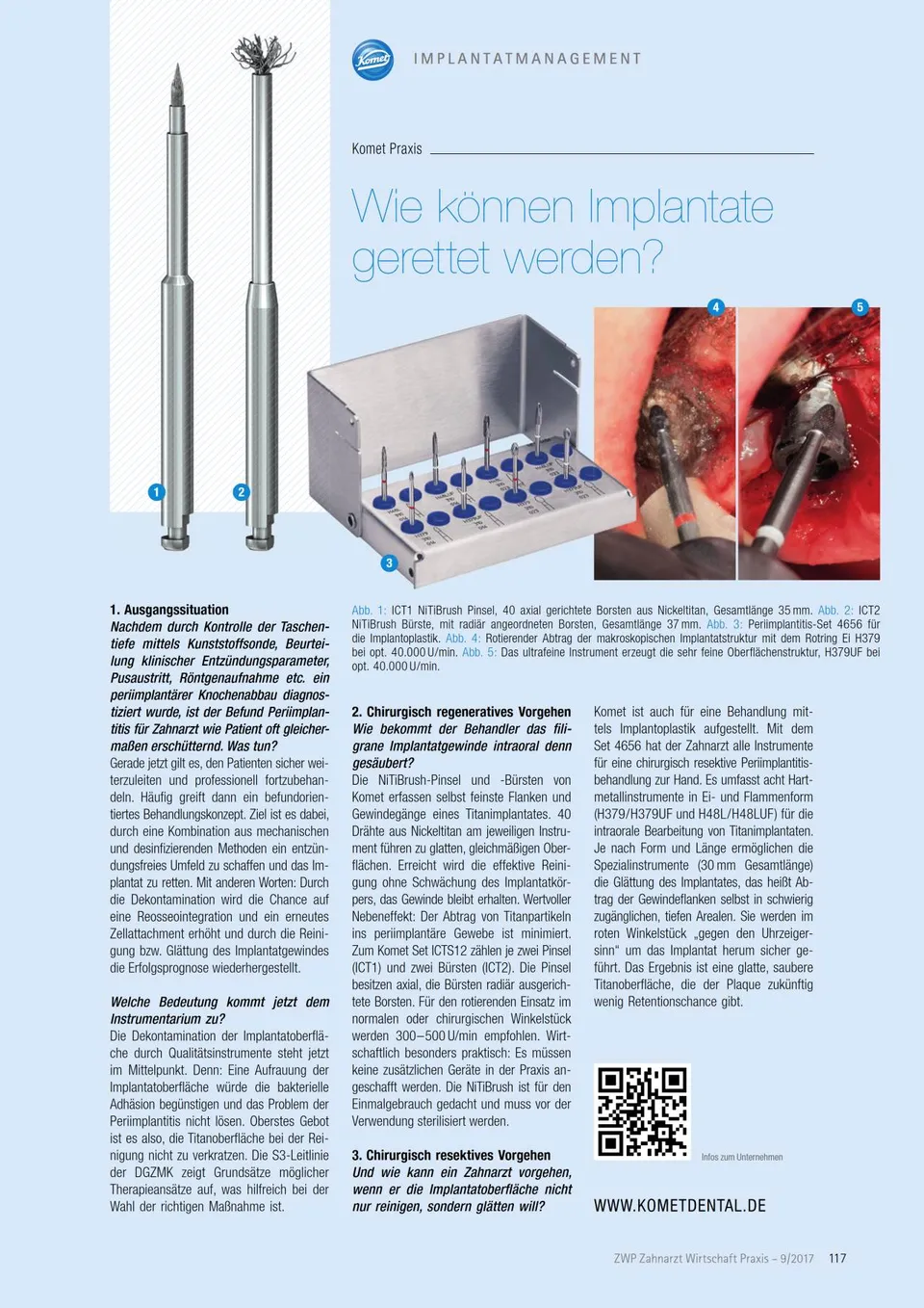 komet-dental-diao-2017-09-praxisartikel-implantate-retten image 1
