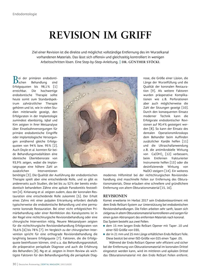 komet-dental-fq-fachbericht-revision-im-griff-endodontie image 1