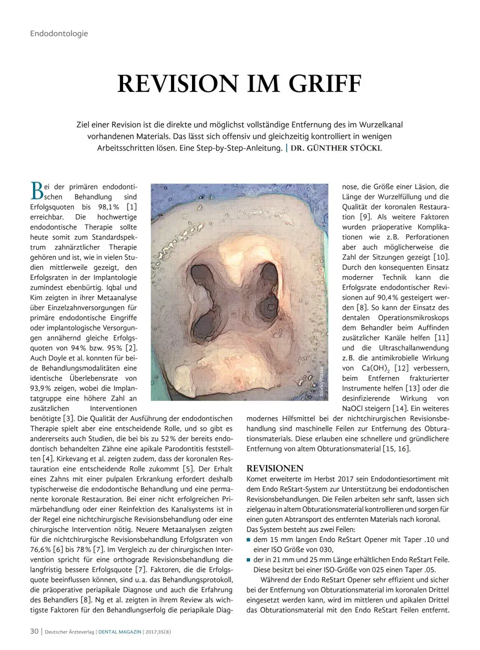 komet-dental-fq-fachbericht-revision-im-griff-endodontie image 1