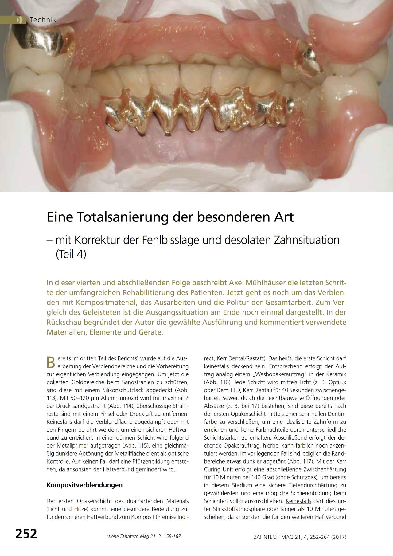 komet-diao-fachbericht-totalsanierung-teil-4-fehlbisslage image 1