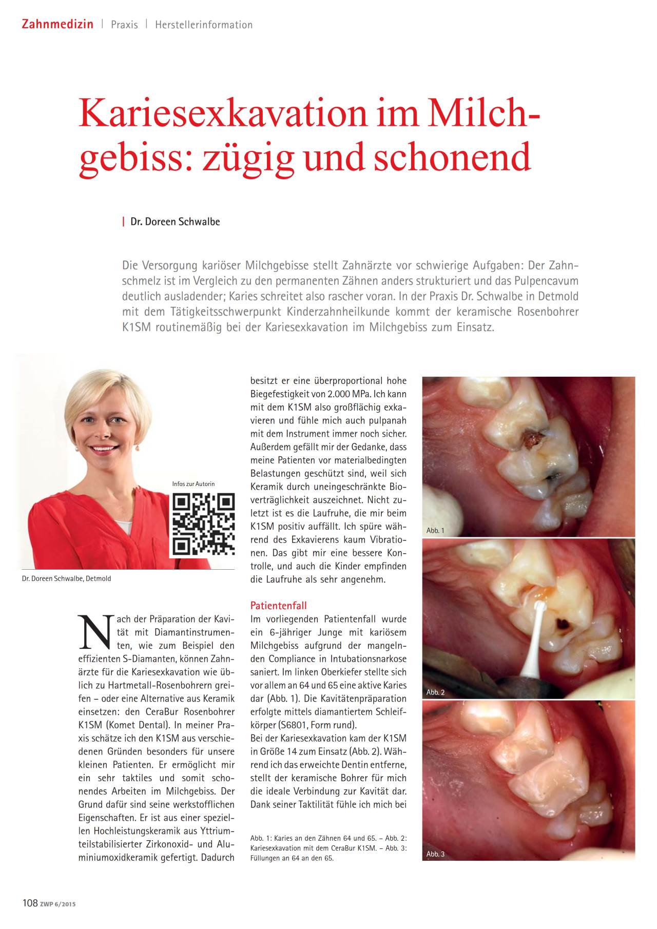 komet-dental-diao-fachbericht-karies-milchgebiss image 1