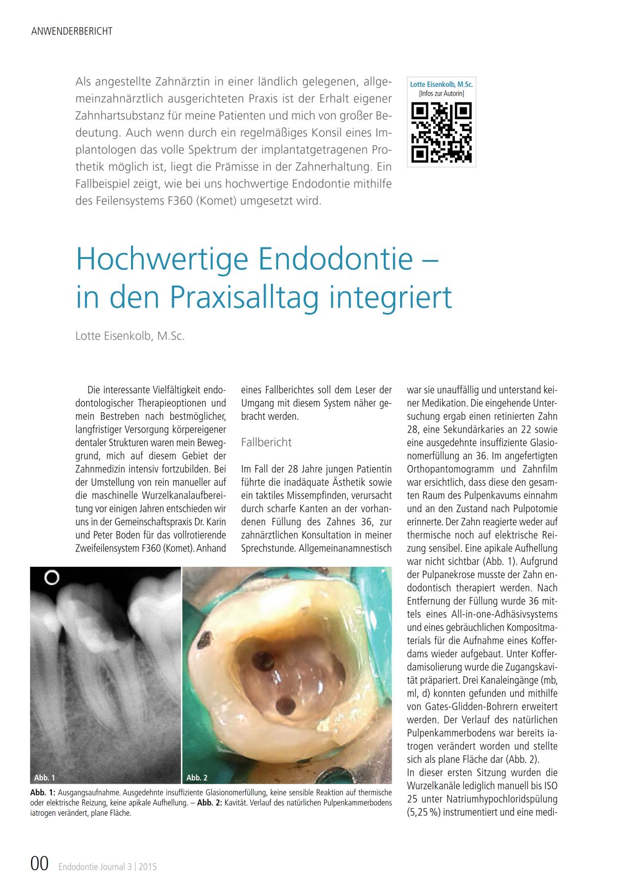 komet-dental-fq-f360-fachbericht-endodontie-08-2015 image 1