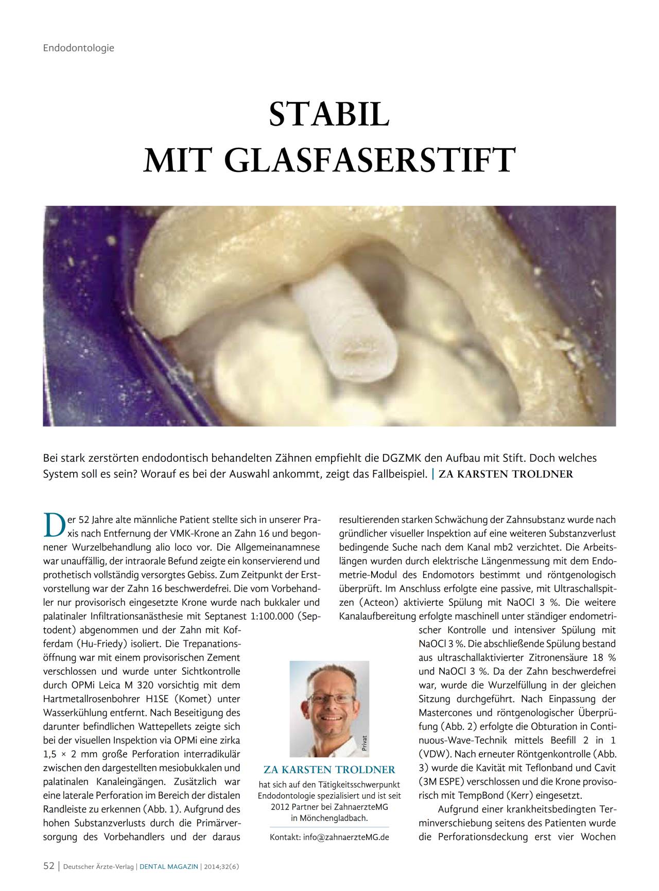 komet-cerapost-glasfaserstift-fachbericht-stiftaufbau image 1