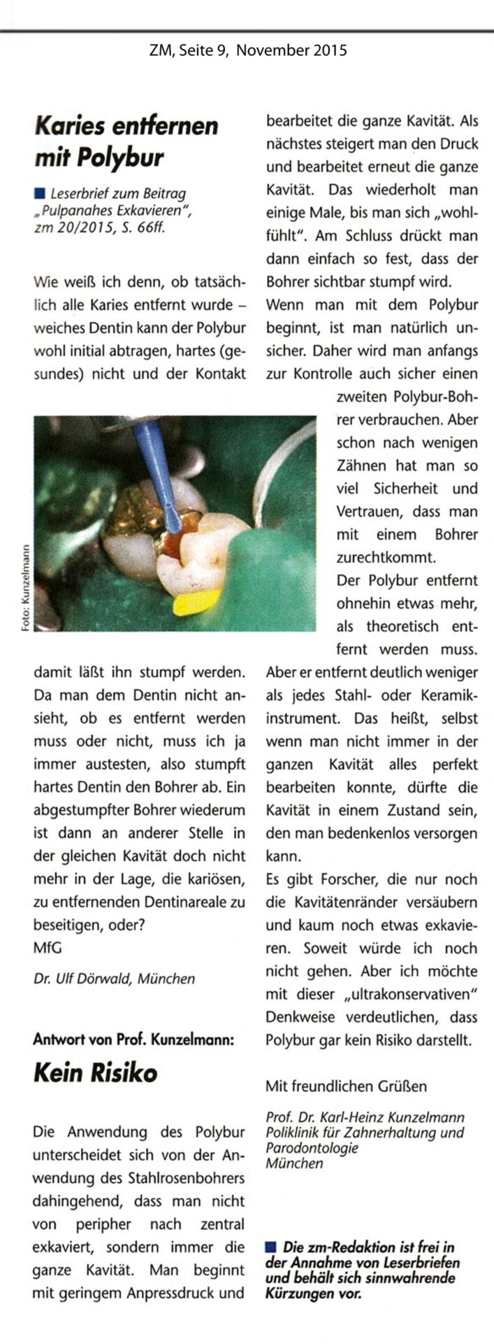 komet-dental-polybur-karies-entfernen-fachbericht-pulpanah image 1