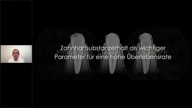 komet-dental-cerapost-webinar-glasfaserstifte image 1
