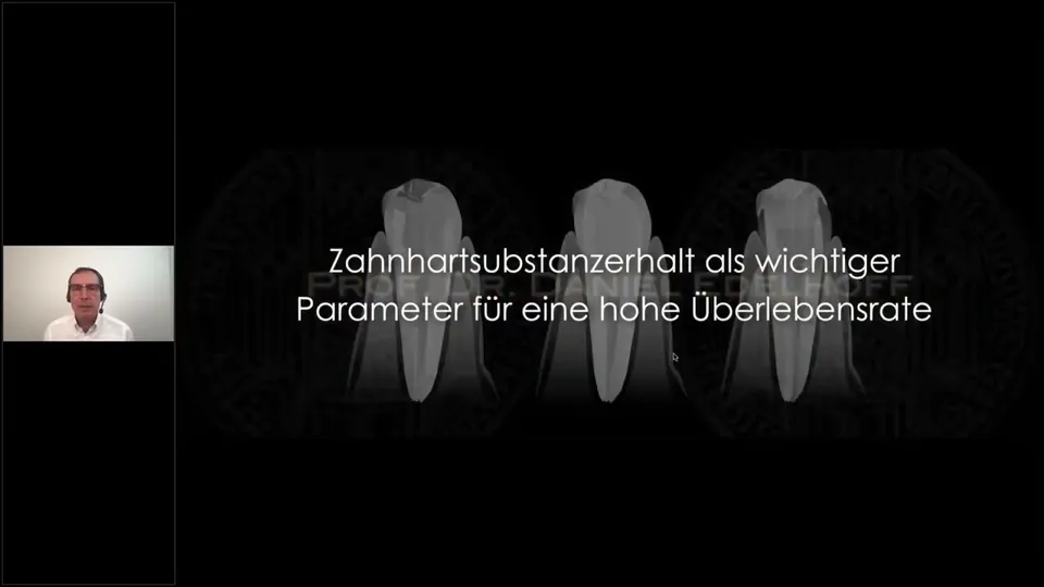 komet-dental-cerapost-webinar-glasfaserstifte image 1