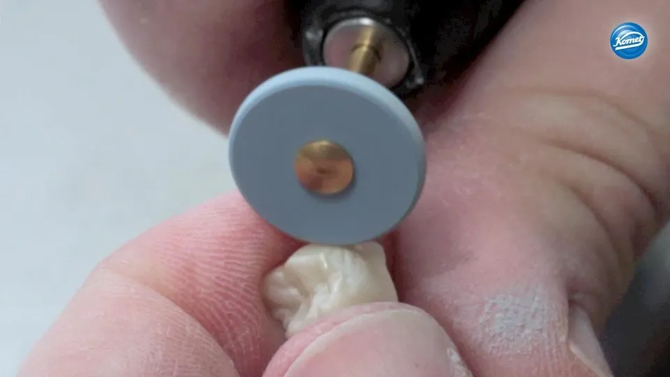 komet-dental-ceracut-video-zirkonoxid-krone-politur image 1