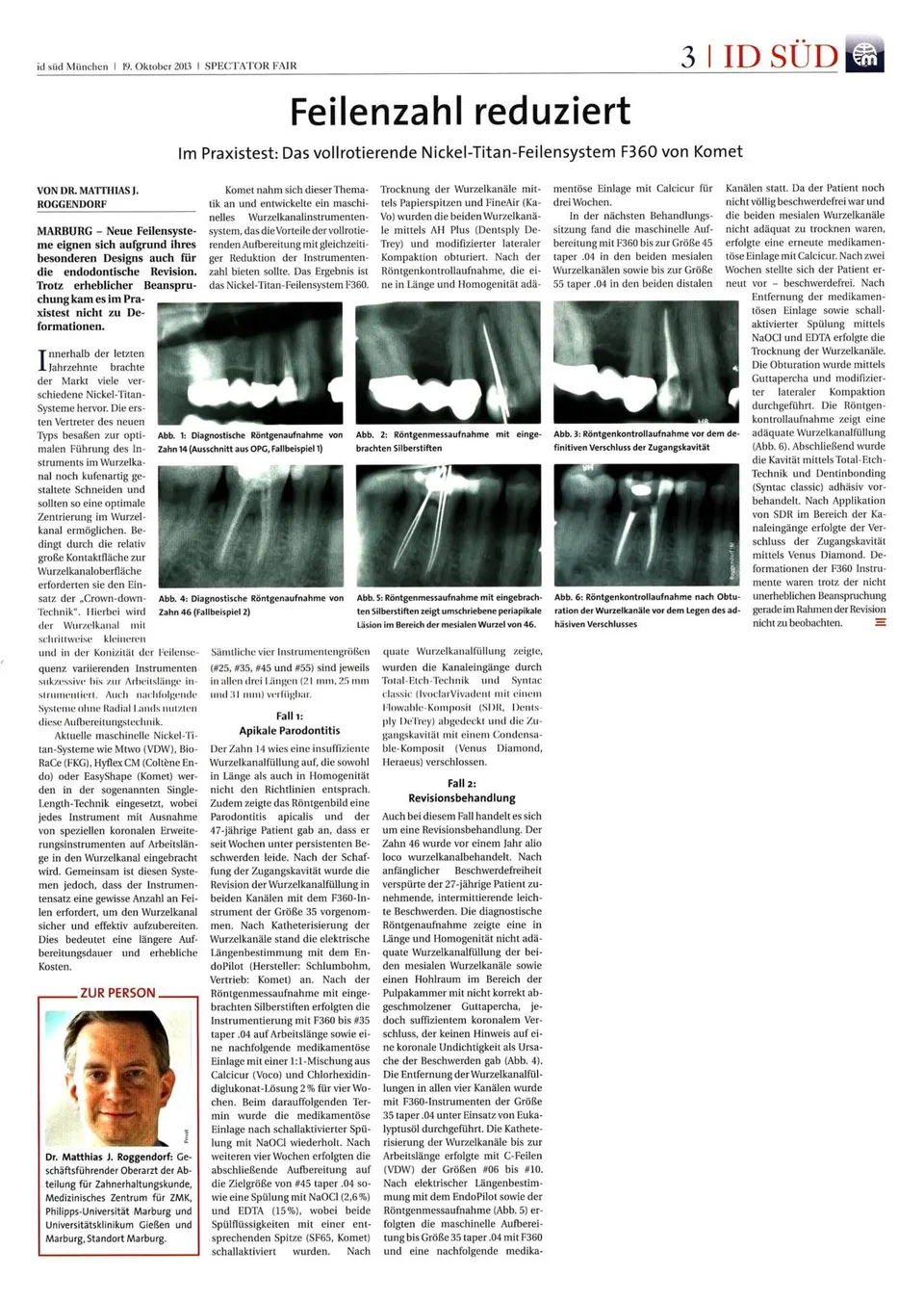 komet-f360-feilen-fachbericht-nickel-titan-praxistest image 1