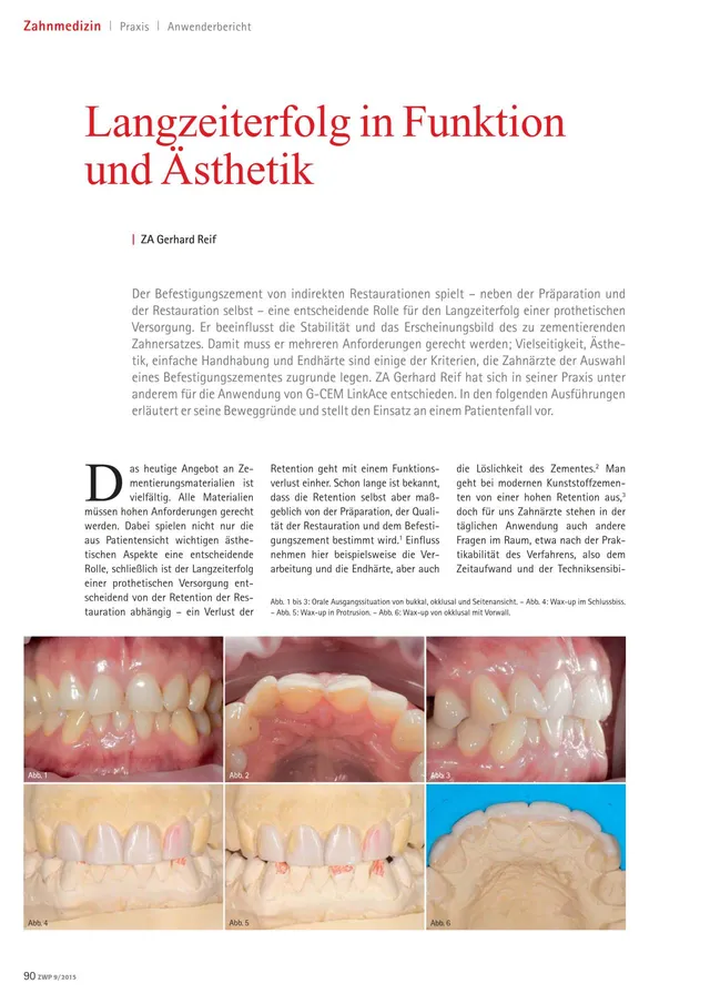 komet-diao-fachbericht-befestigungszement-restauration image 1