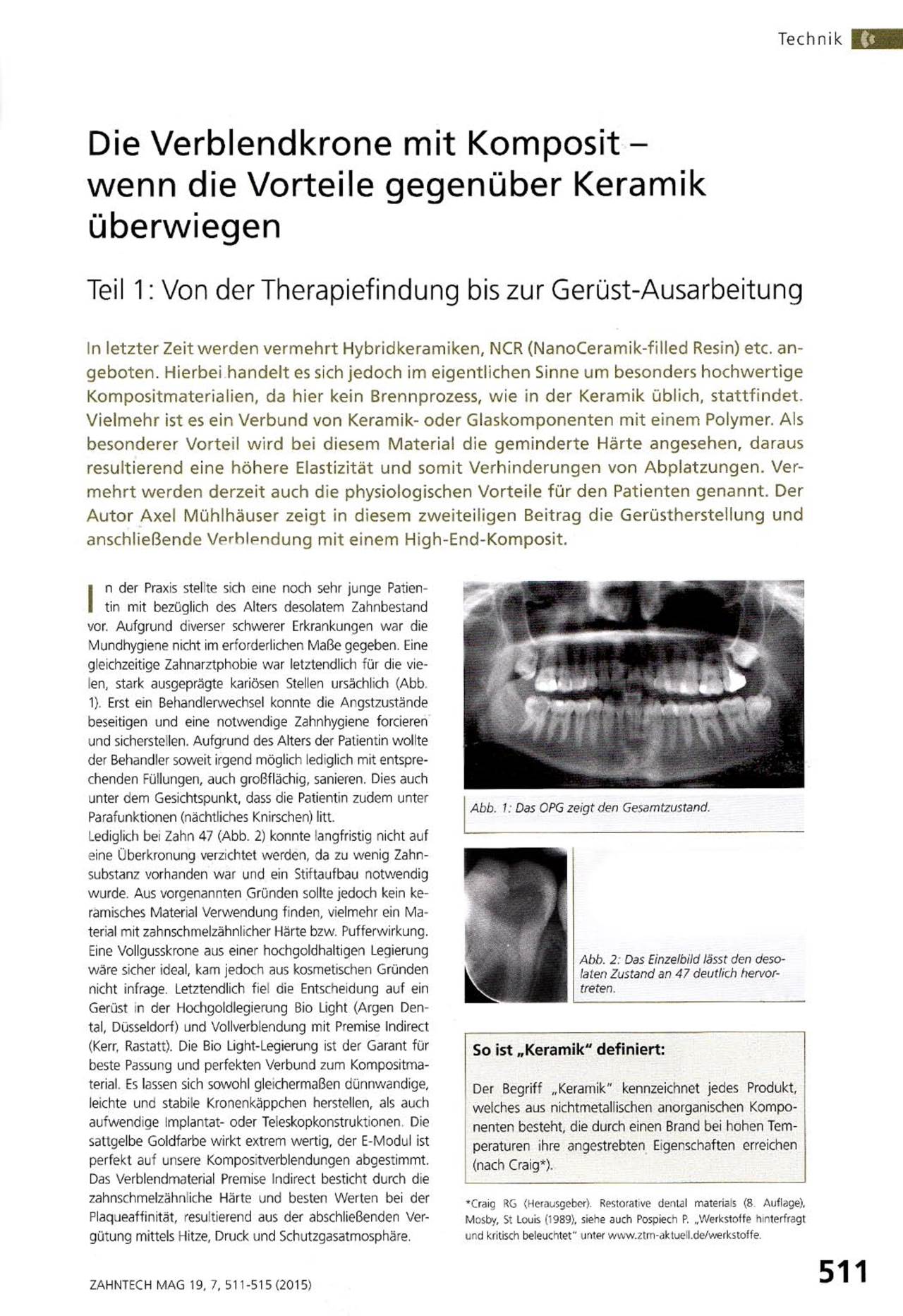 komet-dental-ceracut-fachbericht-verblendkrone-komposit-teil-1 image 1