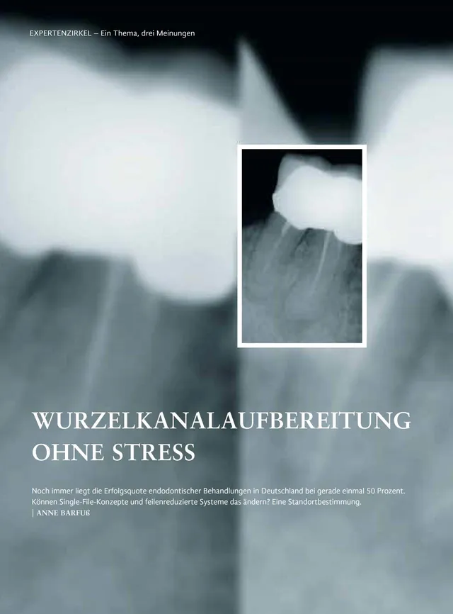 komet-dental-fq-fb-fachbericht-wurzelkanalaufbereitung-02-2017 image 1