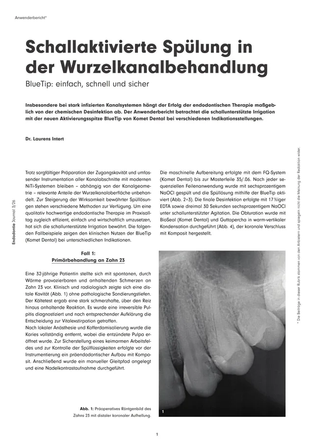 komet-dental-sonicline-fachbeitrag-schallsp-lung-wurzelkanal image 1