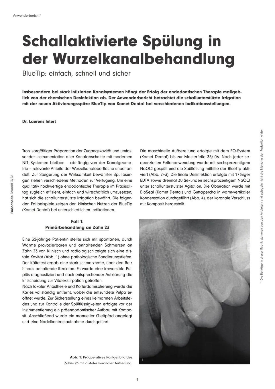 komet-dental-sonicline-fachbeitrag-schallsp-lung-wurzelkanal image 1