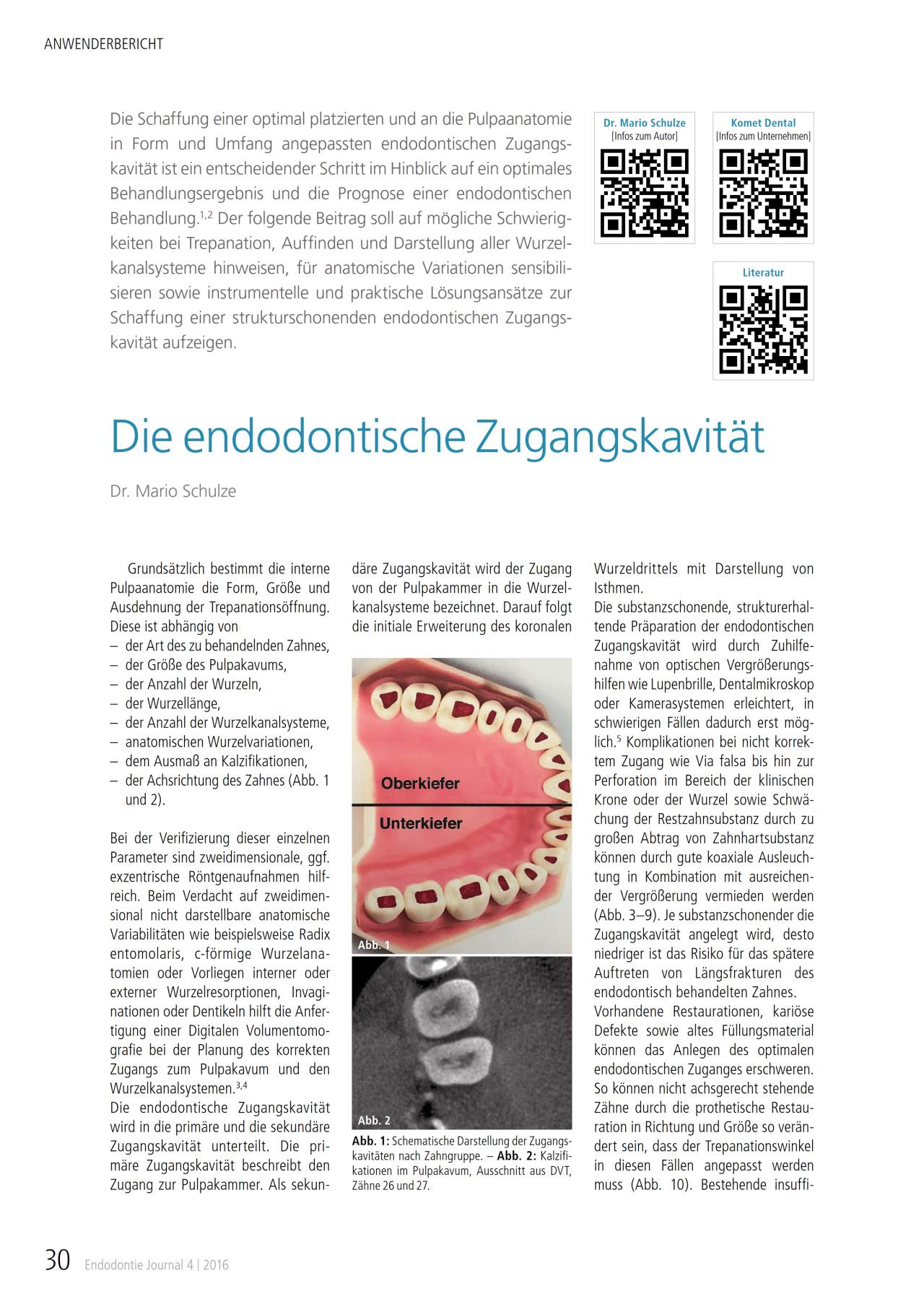 komet-dental-fq-die-endodontische-zugangskavitu00e4t-fachbericht-11-2016 image 1