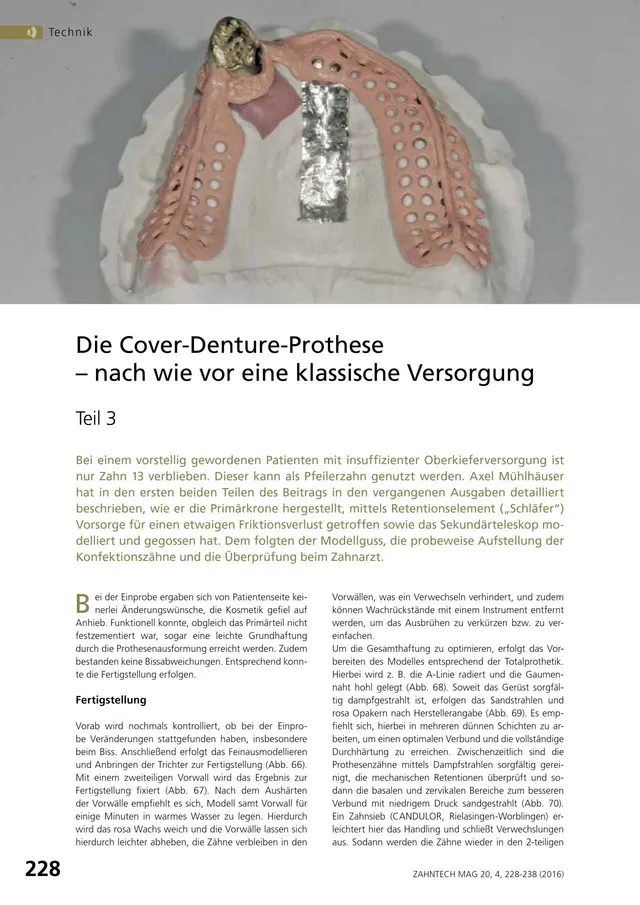 komet-shax-fachbericht-cover-denture-prothese-teil-3-m-hlhaeuser image 1