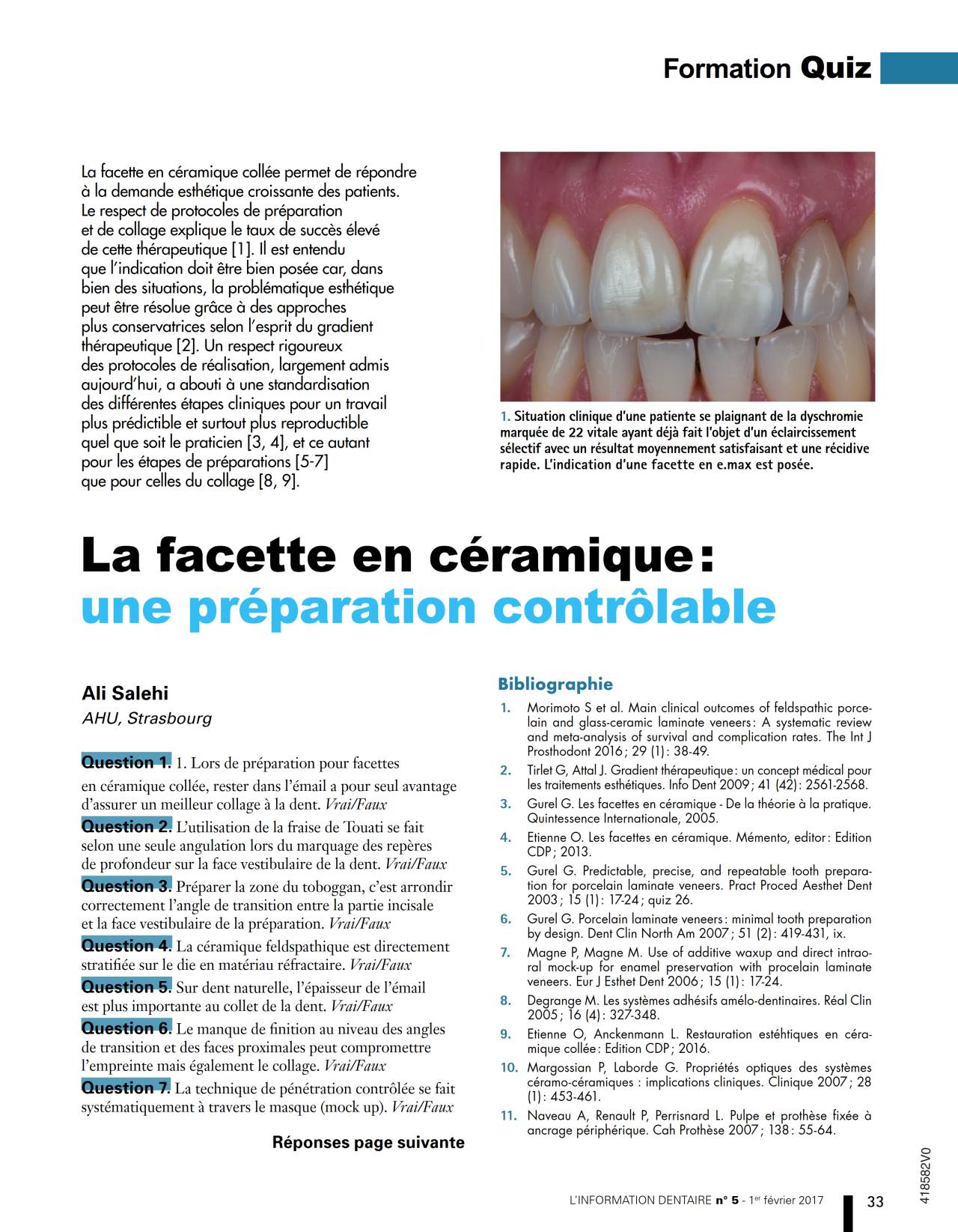komet-dental-diao-quiz-keramik-veneers-fachartikel-salehi image 1