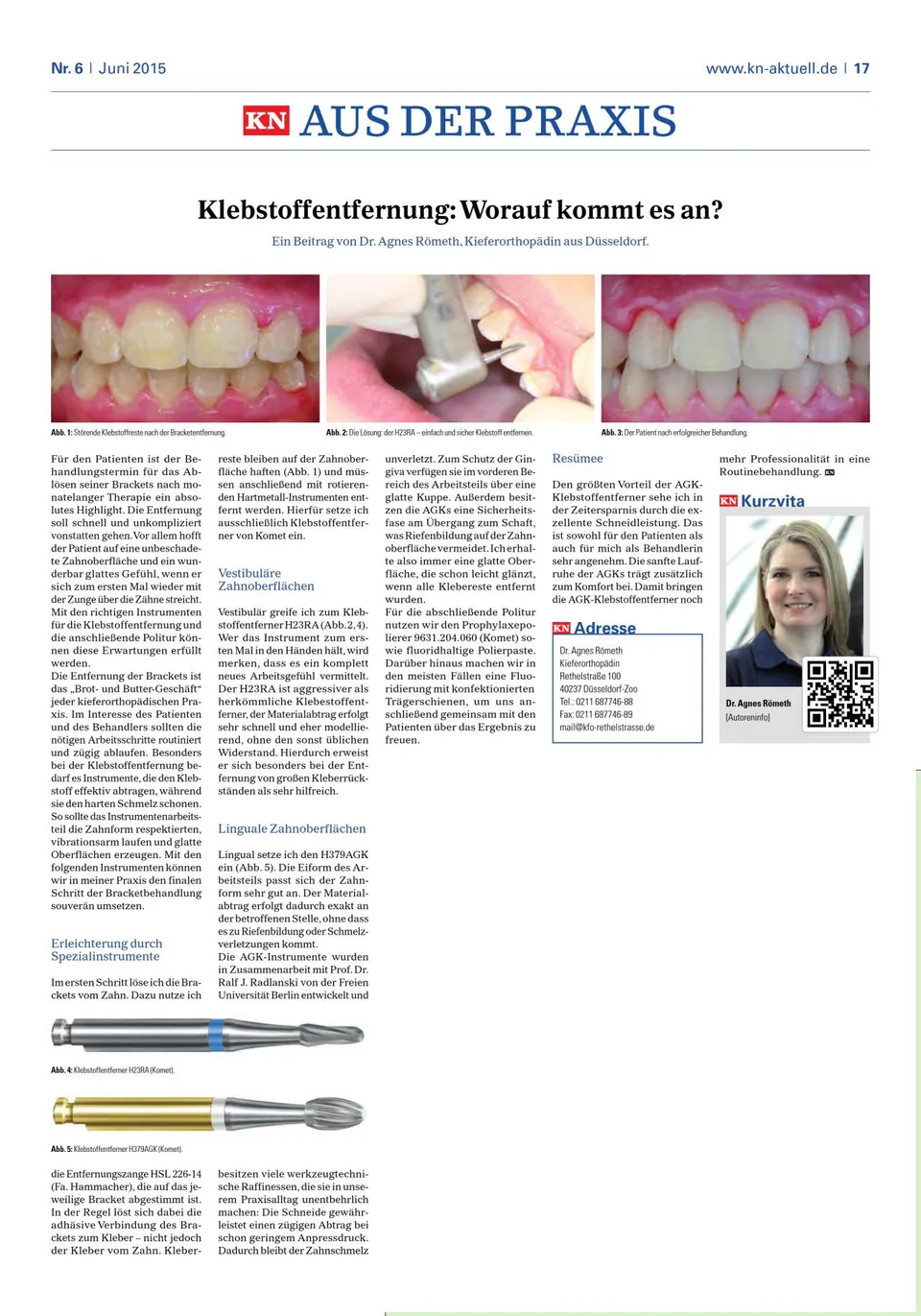 komet-diao-fachbericht-klebstoffentfernung-dr-r-meth image 1