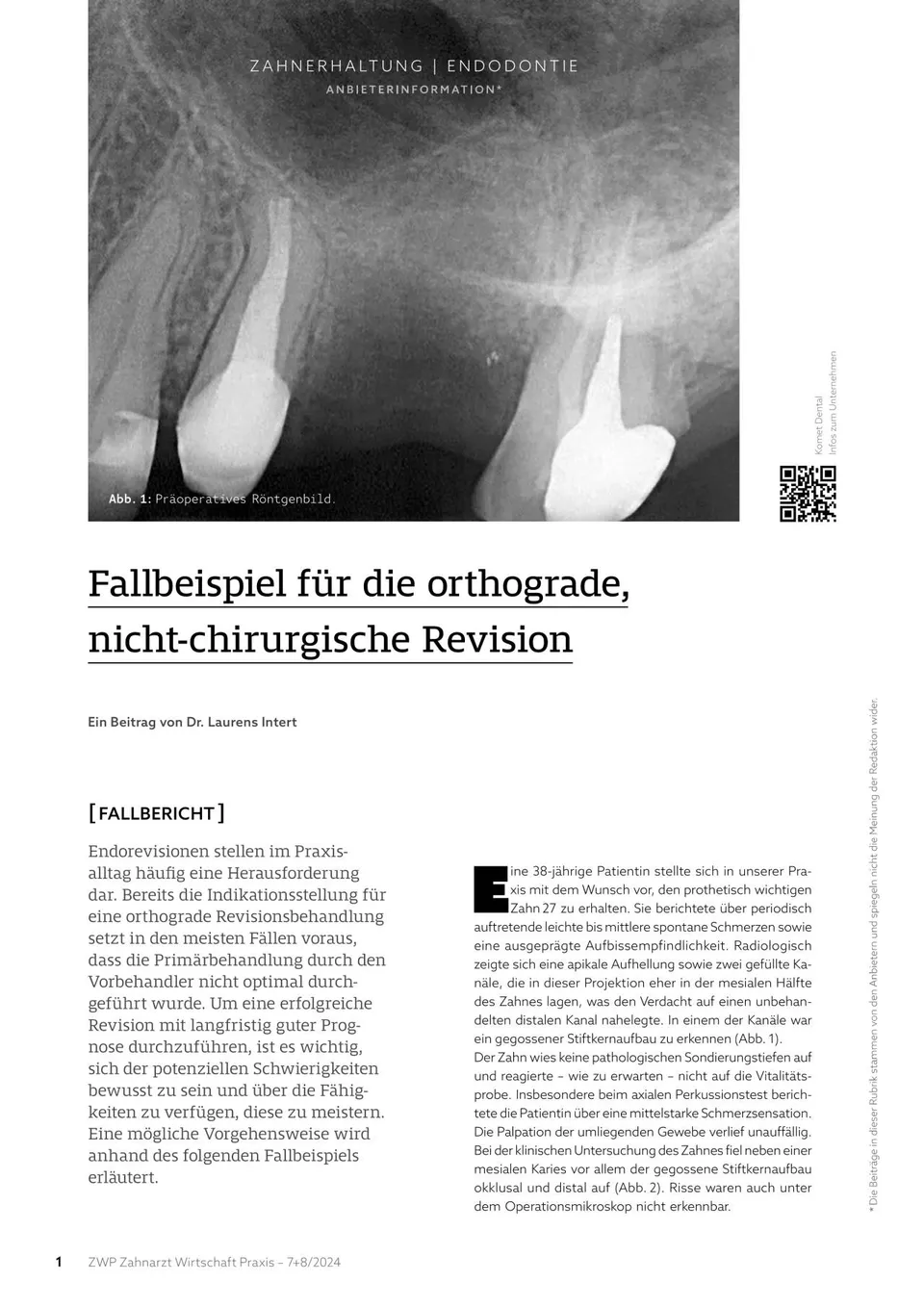 komet-dental-diao-komet-praxis-07-2024-fachartikel-zahnerhaltung-endodontie image 1