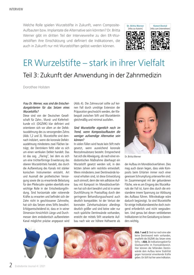 komet-dental-er-system-fachbericht-wurzelstifte-vielfalt-teil-1 image 1