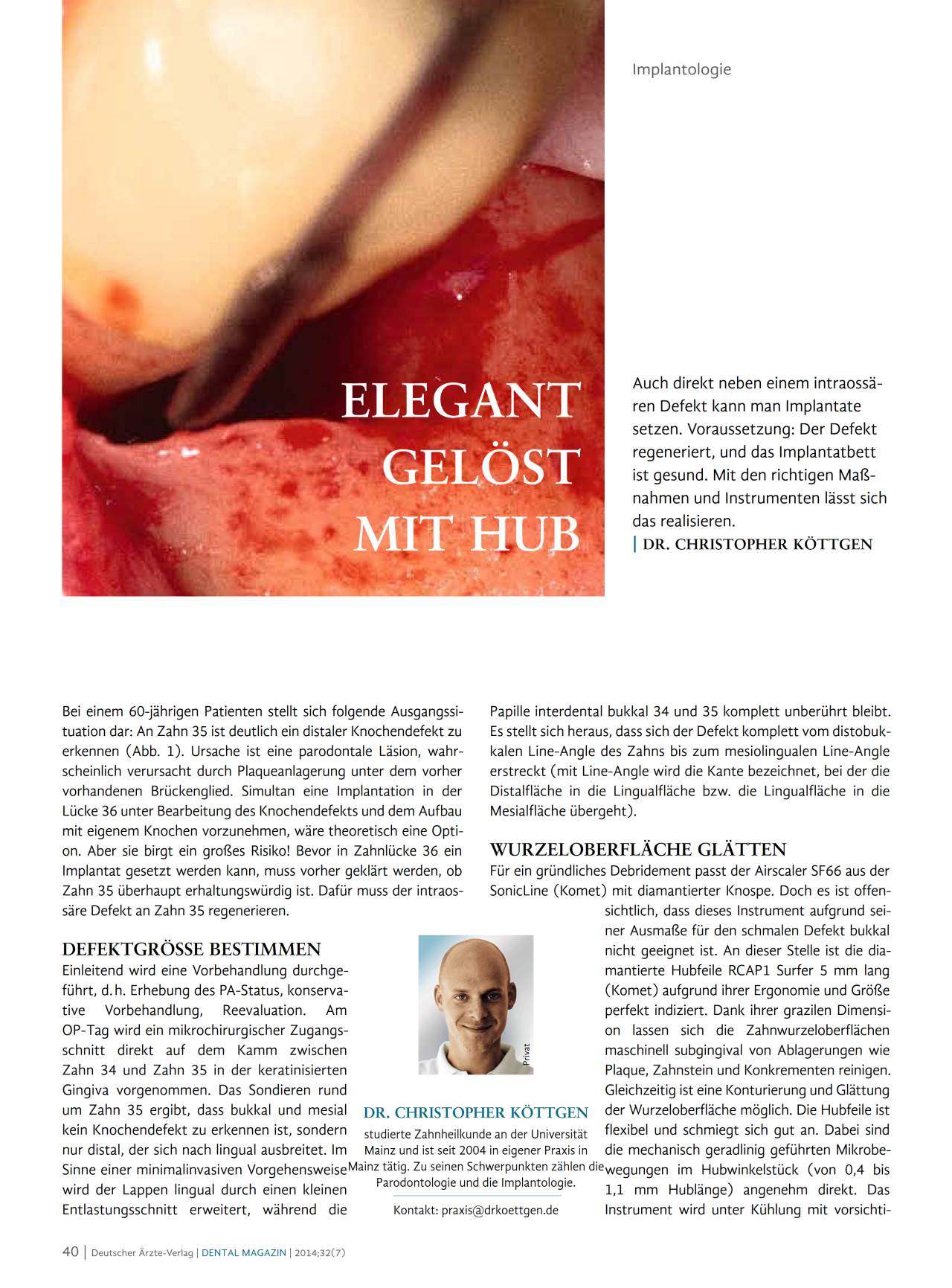 komet-diao-fachbericht-hub-elegant-gel-st-dm-ausgabe-7 image 1