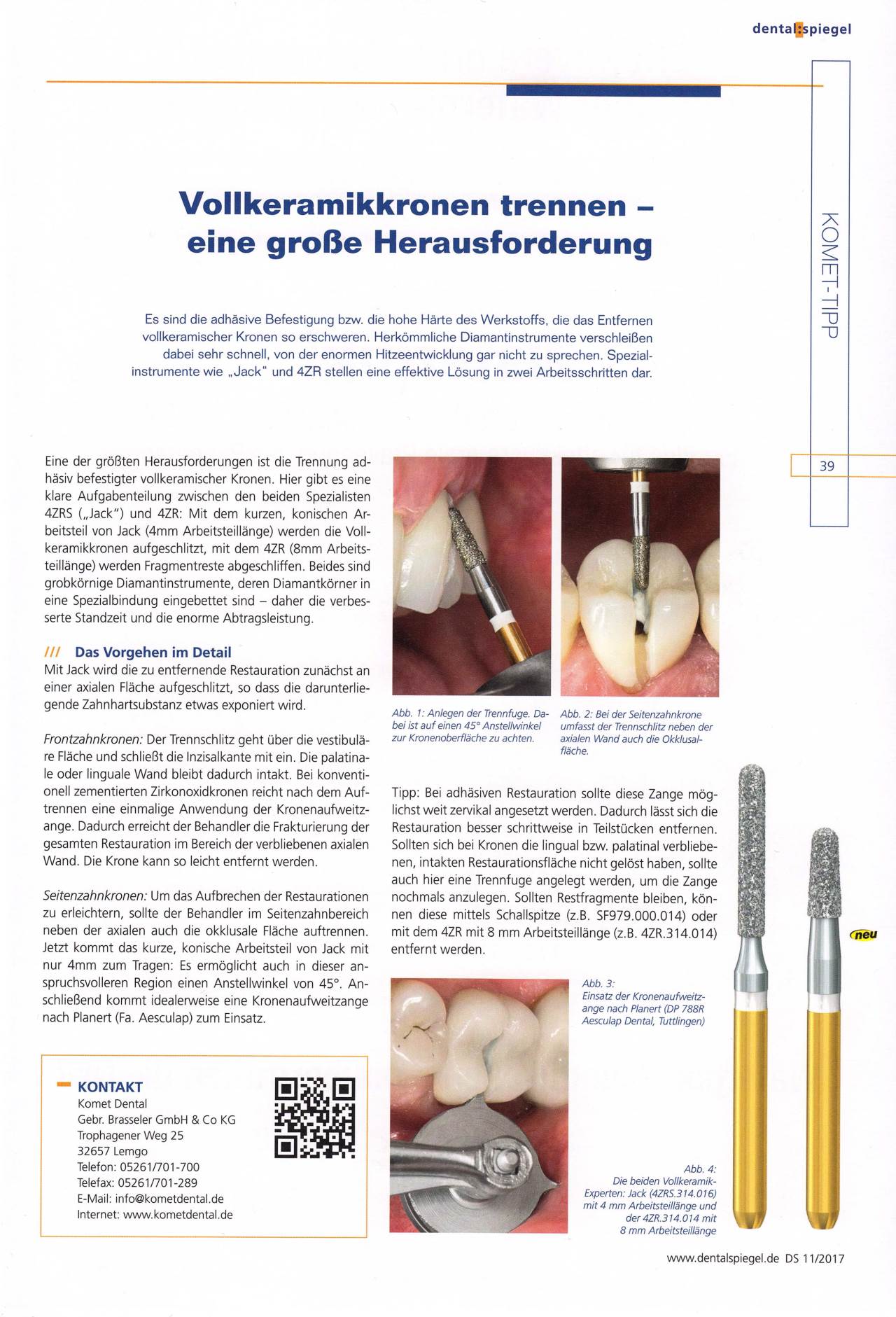 komet-diao-komet-tipp-2017-11-endo-restart-revision image 1