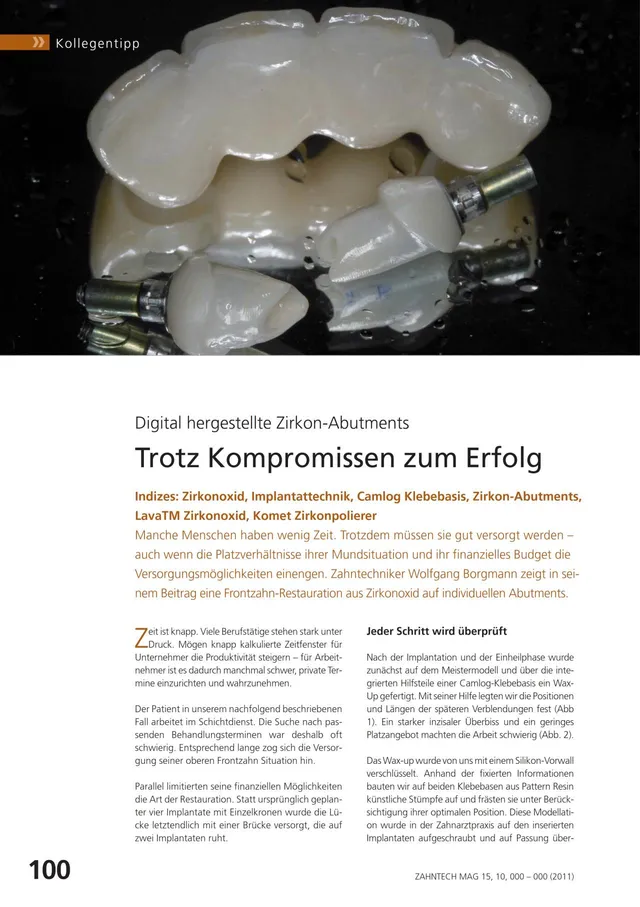 komet-ceracut-zirkonoxid-fachbericht-zirkon-abutments image 1